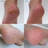 Heal Repair Duo - Purple - (Balm + Heel Socks)